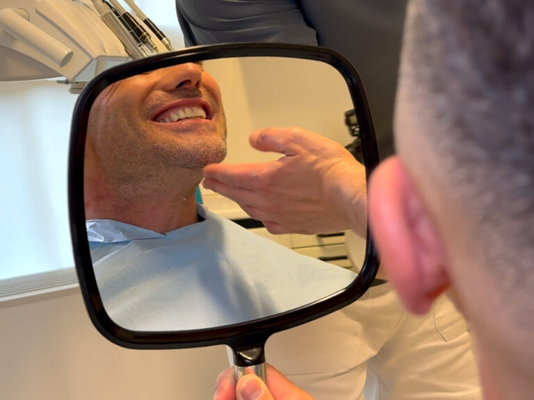 Faccette dentali
