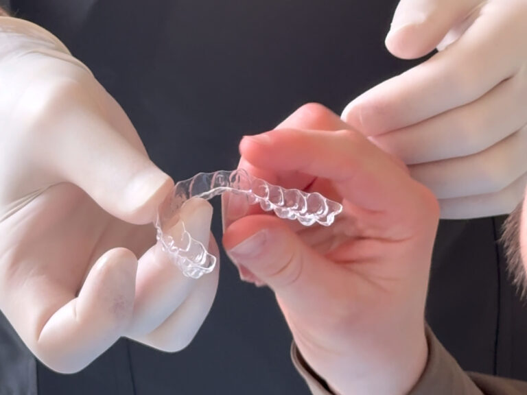 Apparecchio trasparente come funziona