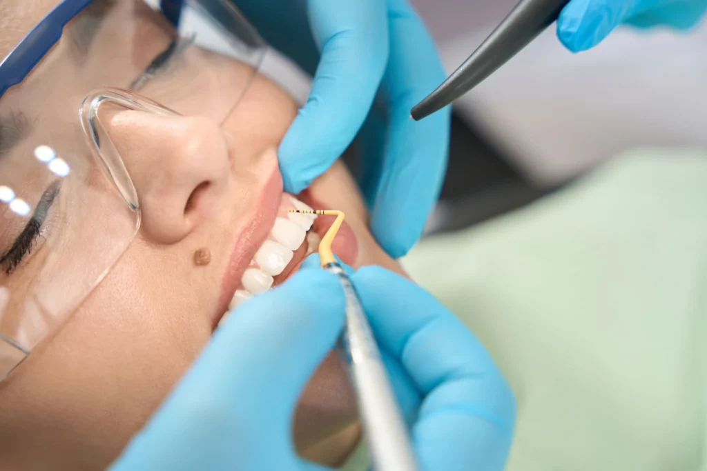 Ogni quanto fare la pulizia dentale